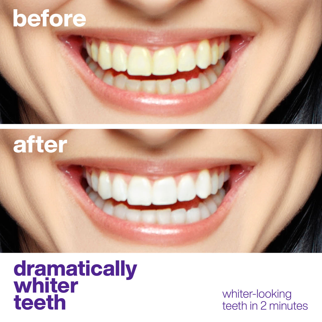 Perfect Purple Teeth Whitening, Color-Correcting Serum