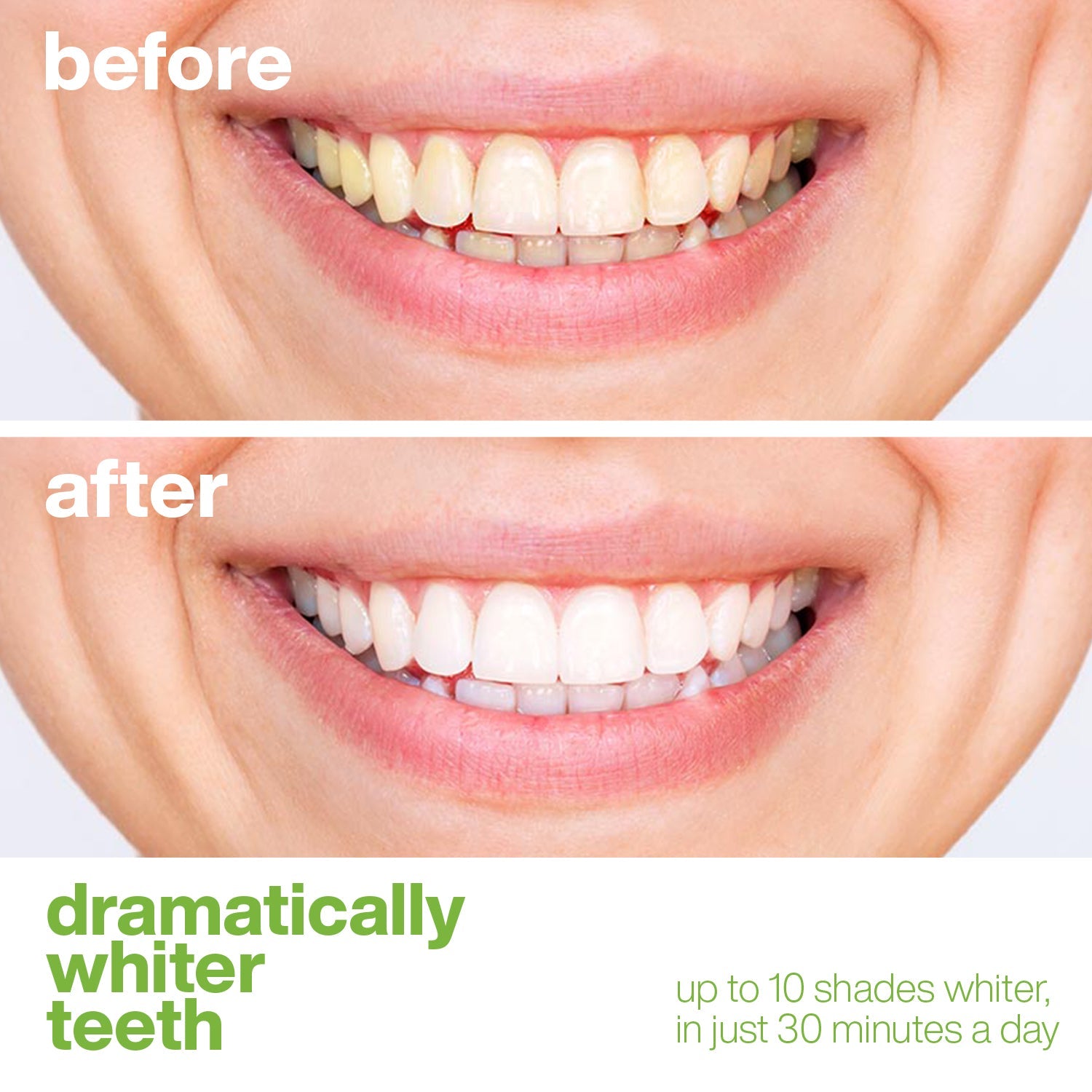 AquaSonic Teeth Whitening Strips - Thumbnail 5